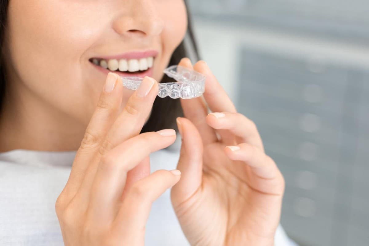 Feldman Orthodontics Compares Clear Ceramic Braces and Metal Braces for Families in Southington, Cheshire, and Beyond