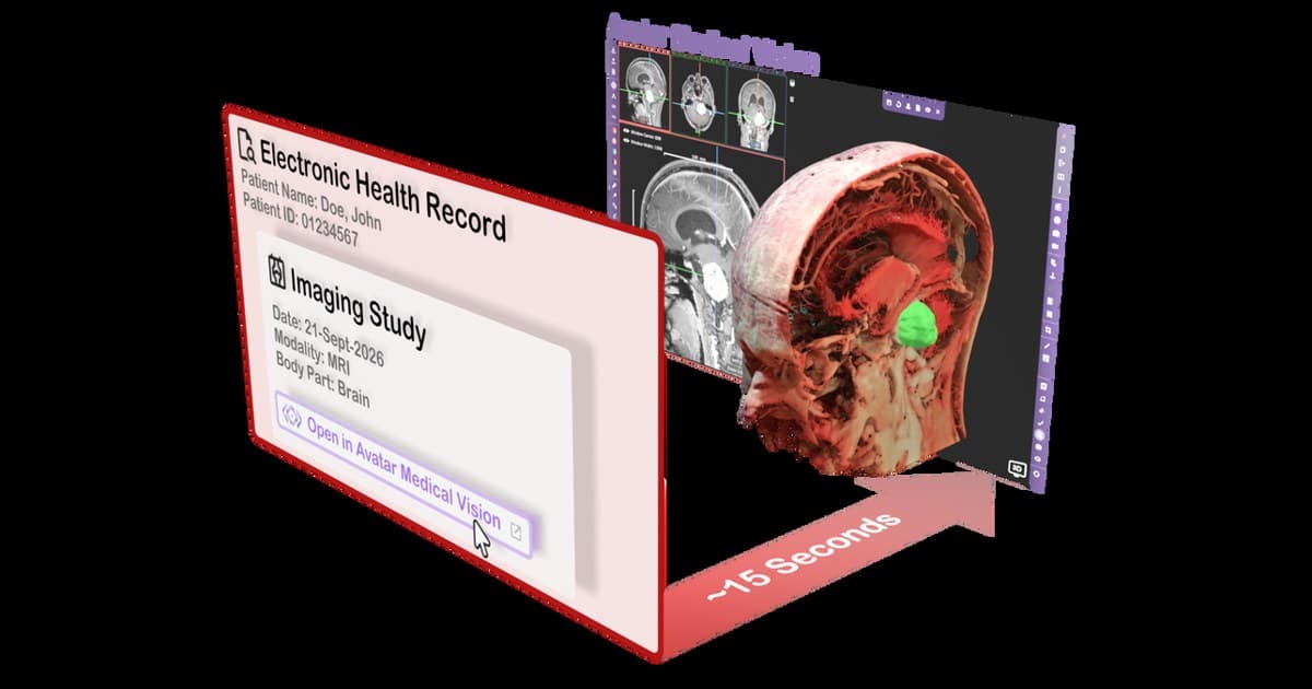 Avatar Medical Integrates Patient-Specific 3D Imaging with Epic EHR, Streamlining Clinical Consultations