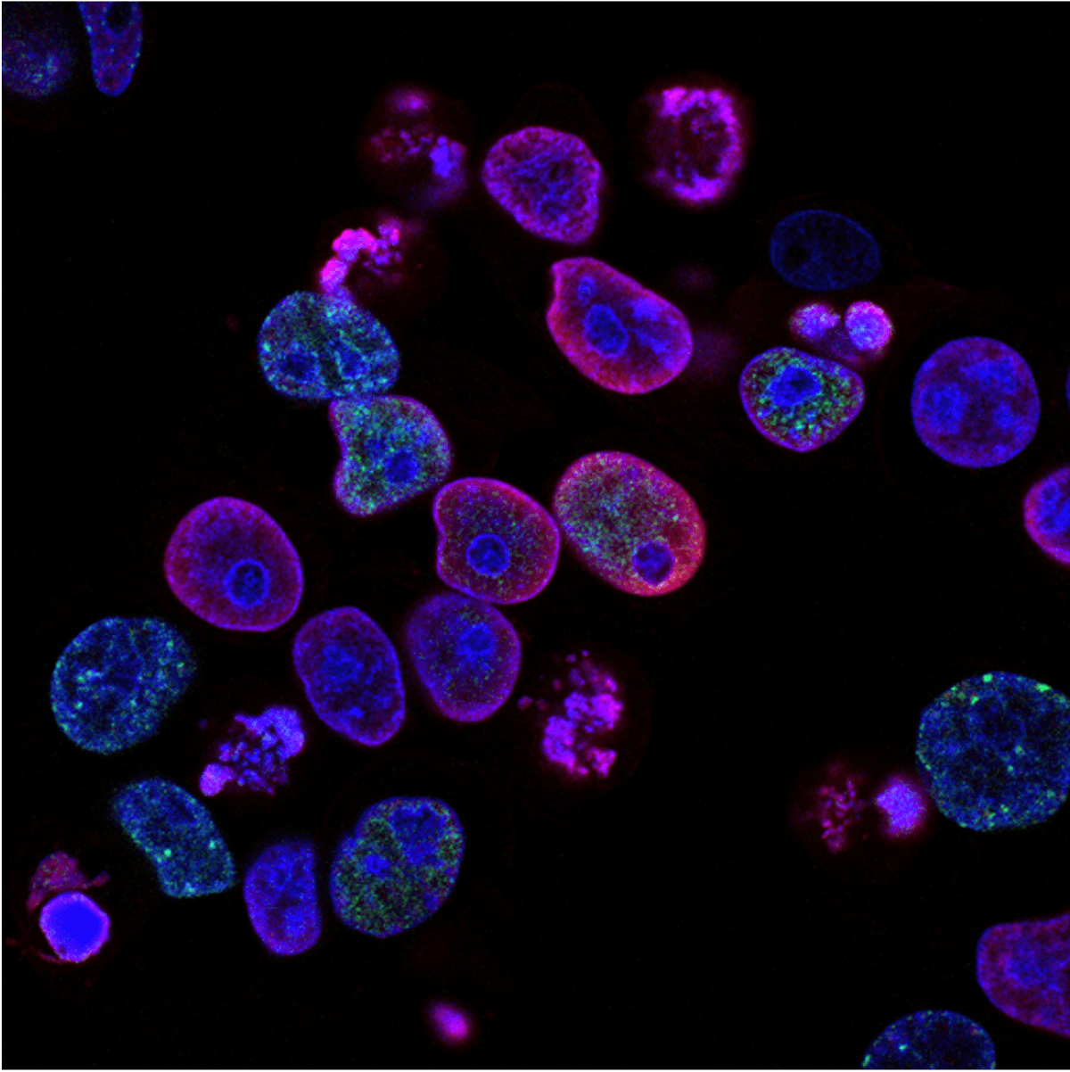 Vivos Advances Cancer Treatment with FDA Application for Human Trials of RadioGel