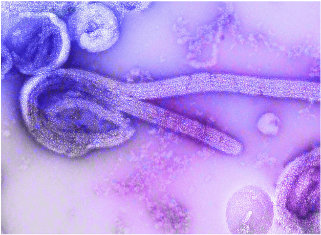 RedHill Biopharma Receives BARDA Funding to Advance Opaganib as Potential Ebola Treatment