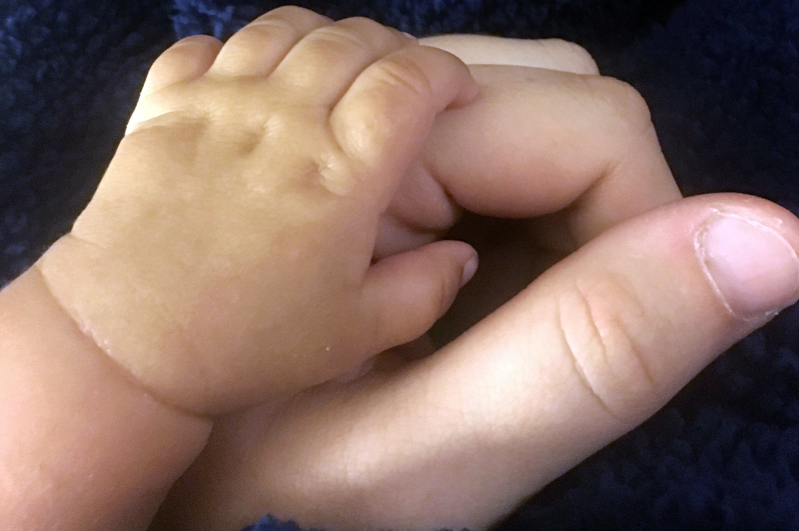 Study Reveals Higher Cancer Risk for Newborns with Heart Defects