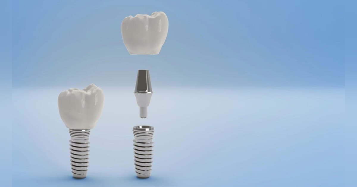 Gunbarrel Dental Center Expands Patient Education on Professional Teeth Whitening Options