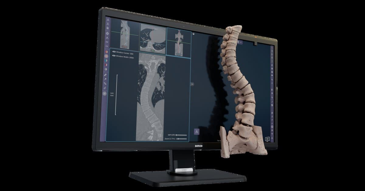 Avatar Medical Secures CE Marking for Glasses-Free 3D Medical Visualization Software